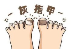 西寧在哪個(gè)醫(yī)院治灰指甲好