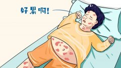 西寧哪家醫(yī)院治牛皮癬好點(diǎn)